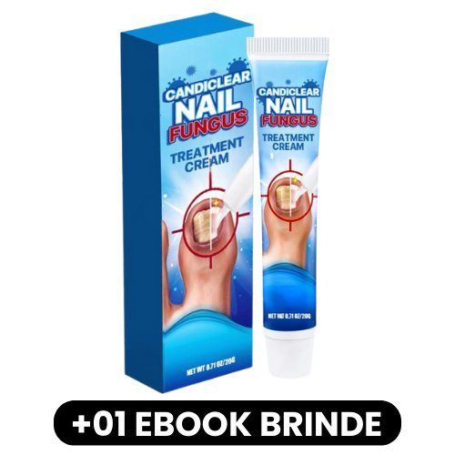 Candiclear - Creme de Tratamento para Fungos nas Unhas - Mania das CoisasCandiclear - Creme de Tratamento para Fungos nas UnhasMania das Coisas