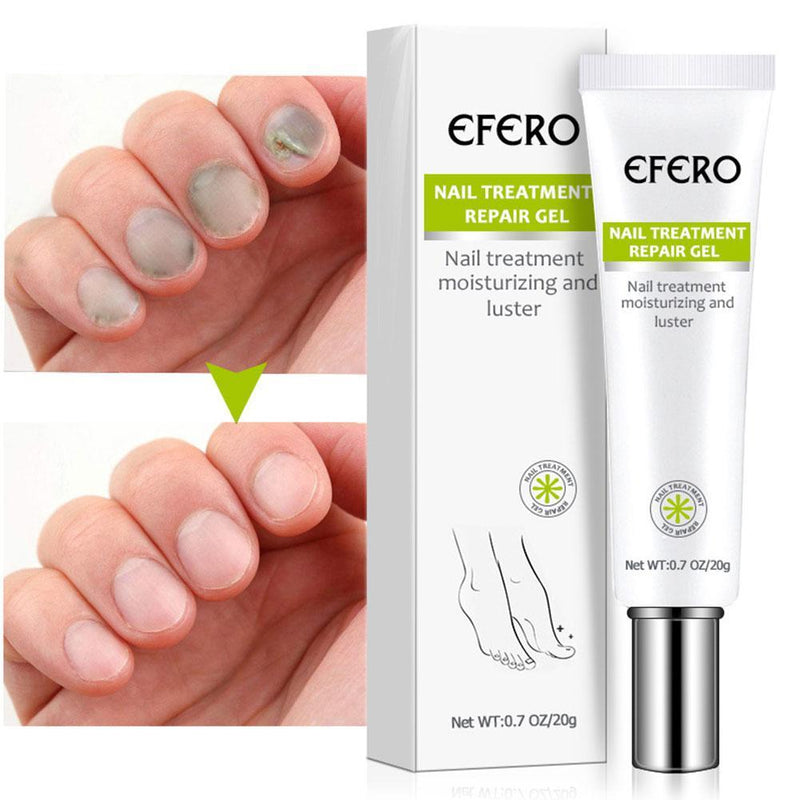 EFERO - Creme anti-fungos para os pés + E-book de graça - Mania das CoisasEFERO - Creme anti-fungos para os pés + E-book de graçaMania das Coisas